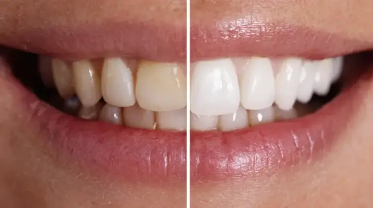 The dental whitening revolution in the form of a toothpaste, which is already Nº1 on Amazon, arrives in Spain.